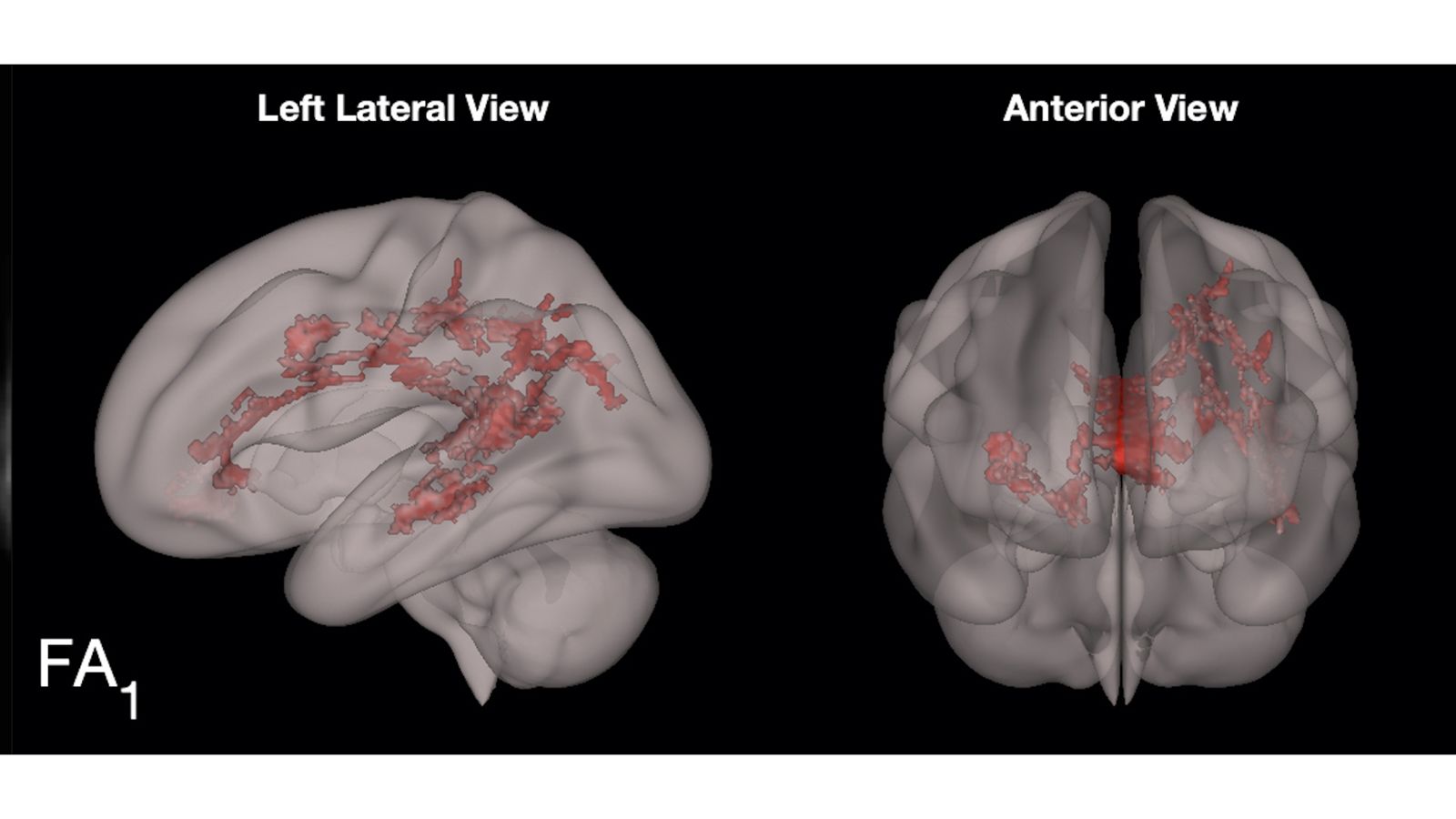 Reading benefits: This is your child's brain on books vs screen time | CNN